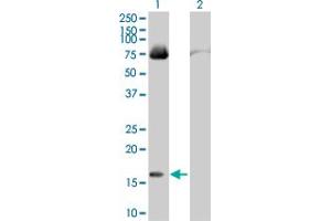 Western Blot analysis of FABP4 expression in transfected 293T cell line by FABP4 MaxPab polyclonal antibody. (FABP4 抗体  (AA 1-132))