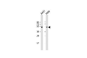 All lanes : Anti-p53 Antibody (S15) at 1:2000 dilution Lane 1: A431 whole cell lysate Lane 2: Hela whole cell lysate Lysates/proteins at 20 μg per lane. (p53 抗体  (AA 1-30))