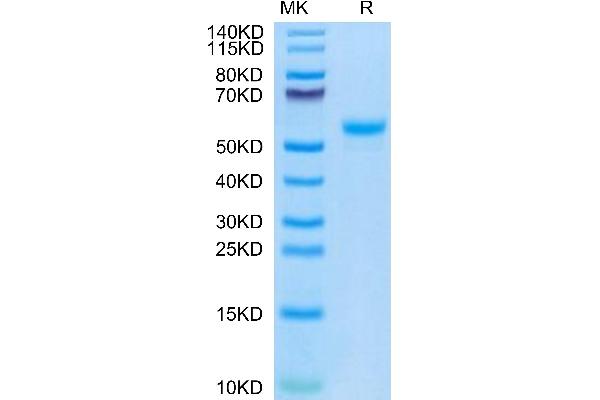 CPM Protein (AA 18-423) (His tag)