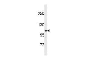 Western blot analysis in SK-BR-3 cell line lysates (35ug/lane). (MYLK 抗体  (N-Term))