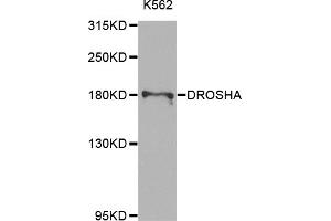 Western blot analysis of extracts of K-562 cells, using DROSHA antibody (ABIN5975795) at 1/1000 dilution. (DROSHA 抗体)