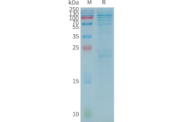 BTK Protein (AA 1-659) (DYKDDDDK Tag)