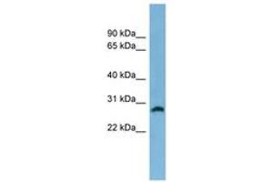 Image no. 1 for anti-Steroid-5-alpha-Reductase, alpha Polypeptide 2 (3-Oxo-5 alpha-Steroid delta 4-Dehydrogenase alpha 2) (SRD5A2) (AA 35-84) antibody (ABIN6744768) (SRD5A2 抗体  (AA 35-84))