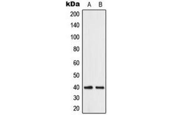 ABHD12B 抗体  (C-Term)