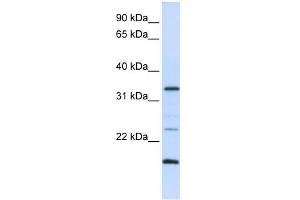 Western Blot showing ARGFX antibody used at a concentration of 1-2 ug/ml to detect its target protein. (ARGFX 抗体  (N-Term))