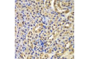 Immunohistochemistry (IHC) image for anti-Nuclear Factor of kappa Light Polypeptide Gene Enhancer in B-Cells Inhibitor, alpha (NFKBIA) (AA 1-317) antibody (ABIN3021668) (NFKBIA 抗体  (AA 1-317))