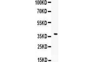 Anti- CD86 Picoband antibody, Western blotting All lanes: Anti CD86  at 0. (CD86 抗体  (AA 24-329))