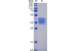Human C Protein, mFc Tag on SDS-PAGE under reducing condition. (Claudin 6 Protein (CLDN6) (AA 1-4) (mFc Tag))