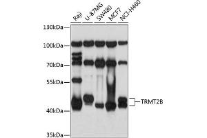 Western blot analysis of extracts of various cell lines, using TRMT2B antibody  at 1:1000 dilution. (TRMT2B 抗体  (AA 1-250))