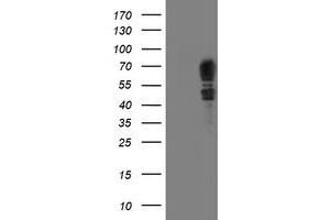 HEK293T cells were transfected with the pCMV6-ENTRY control (Left lane) or pCMV6-ENTRY SCHIP1 (Right lane) cDNA for 48 hrs and lysed. (SCHIP1 抗体)