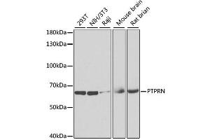 Western blot analysis of extracts of various cell lines, using PTPRN antibody (ABIN2564814) at 1:1000 dilution. (PTPRN 抗体)