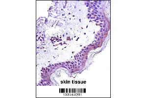 STAT2 Antibody immunohistochemistry analysis in formalin fixed and paraffin embedded human skin tissue followed by peroxidase conjugation of the secondary antibody and DAB staining. (STAT2 抗体  (N-Term))