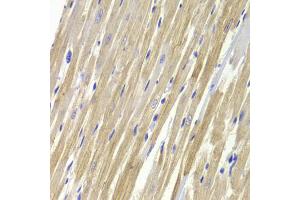 Immunohistochemistry of paraffin-embedded rat heart using GPD1 Antibody. (GPD1 抗体)