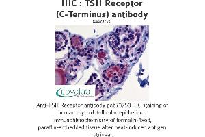 Image no. 1 for anti-Thyroid Stimulating Hormone Receptor (TSHR) (C-Term) antibody (ABIN1740417) (TSH receptor 抗体  (C-Term))