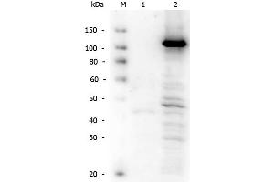 Rabbit anti-hTERT WB Western Blot of Rabbit anti-Telomerase catalytic subunit antibody. (TERT 抗体  (C-Term))