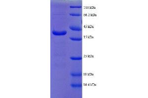 ATP Synthase, H+ Transporting, Mitochondrial F1 Complex, delta Subunit (ATP5D) (AA 43-161), (partial) protein (GST tag) (ATP5F1D Protein (AA 43-161, partial) (GST tag))