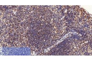 Immunohistochemistry of paraffin-embedded Mouse spleen tissue using CD2 Monoclonal Antibody at dilution of 1:200. (CD2 抗体)