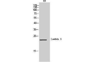 Western Blotting (WB) image for anti-Immunoglobulin lambda-Like Polypeptide 1 (IGLL1) (Internal Region) antibody (ABIN6285798) (IGLL1 抗体  (Internal Region))