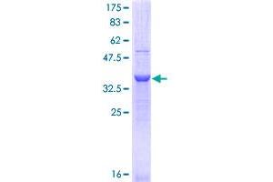 Image no. 1 for Integrin alpha 11 (ITGA11) (AA 793-893) protein (GST tag) (ABIN1308163) (ITGA11 Protein (AA 793-893) (GST tag))