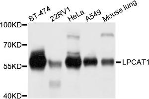 Western blot analysis of extracts of various cell lines, using LPCAT1 antibody (ABIN5972886) at 1/1000 dilution. (LPCAT1 抗体)