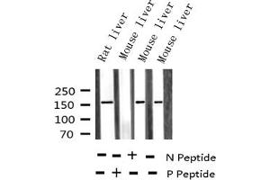 Western blot analysis of Phospho-EGFR (Tyr1110) expression in various lysates (EGFR 抗体  (pTyr1110))