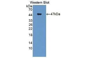 Detection of Recombinant WT1, Human using Polyclonal Antibody to Wilms Tumor Protein (WT1) (WT1 抗体  (AA 310-446))