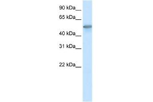 WB Suggested Anti-FOXO3A Antibody Titration:  0. (FOXO3 抗体  (C-Term))