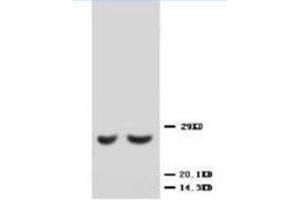Western blot analysis of rat kidney lysis using TIMP2 antibody (TIMP2 抗体  (C-Term))