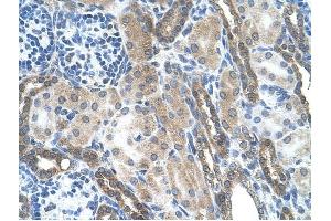 LOC728227 antibody was used for immunohistochemistry at a concentration of 4-8 ug/ml to stain Epithelial cells of renal tubule (arrows) in Human Kidney. (LOC728227 抗体  (C-Term))