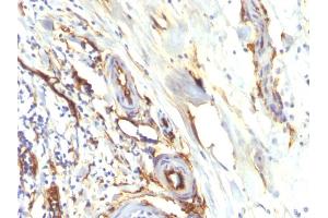 Immunohistochemistry (IHC) image for anti-CD34 (CD34) antibody (ABIN6941175)