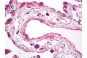 Anti-VEGF antibody IHC of human lung, vascular endothelium. (VEGFA 抗体)