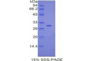 SDS-PAGE analysis of Rabbit CETP Protein. (CETP 蛋白)