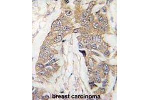 Immunohistochemistry (IHC) image for anti-Cancer Susceptibility Candidate 3 (CASC3) antibody (ABIN3003095) (CASC3 抗体)