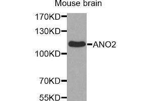 Western blot analysis of extracts of mouse brain, using ANO2 antibody (ABIN5971903). (Anoctamin 2 抗体)