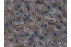 Detection of CK4 in Human Liver Tissue using Polyclonal Antibody to Cytokeratin 4 (CK4) (KRT4 抗体  (AA 152-457))