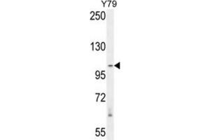 Western Blotting (WB) image for anti-RAS Protein Activator Like 3 (RASAL3) antibody (ABIN2995724) (RASAL3 抗体)