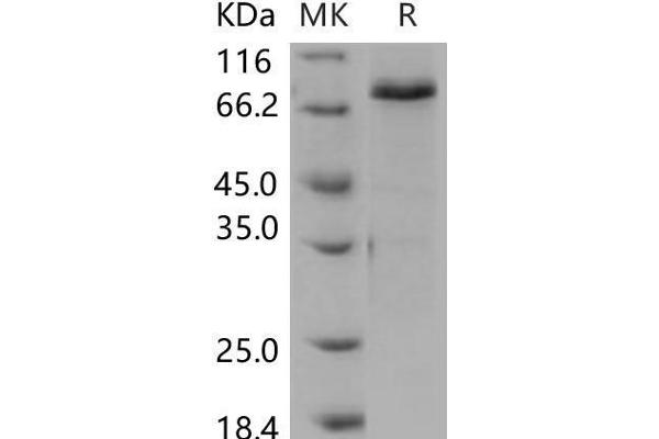 SMAD3 Protein (GST tag,His tag)