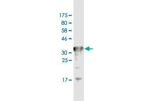 Western Blot detection against Immunogen (36. (Transferrin Receptor 抗体  (AA 68-168))