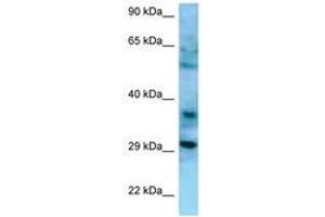 Image no. 1 for anti-CD47 (CD47) (AA 60-109) antibody (ABIN6748299) (CD47 抗体  (AA 60-109))