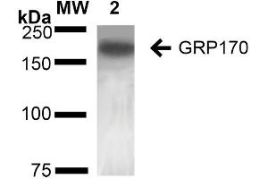 Western Blot analysis of Rat Liver showing detection of ~170 kDa GRP170 protein using Mouse Anti-GRP170 Monoclonal Antibody, Clone 6E3-2C3 (ABIN2868641). (HYOU1 抗体  (HRP))