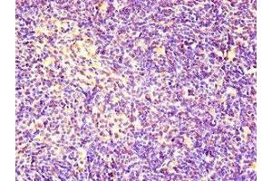 Immunohistochemistry of paraffin-embedded human thymus tissue using ABIN7167020 at dilution of 1:100 (RACGAP1 抗体  (AA 86-331))