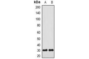 Western blot analysis of Carbonic Anhydrase 3 expression in mouse kidney (A), mouse lung (B) whole cell lysates. (CA3 抗体)