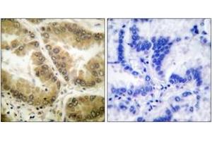 Immunohistochemistry (IHC) image for anti-Histone Deacetylase 7 (HDAC7) (AA 901-950) antibody (ABIN2889211) (HDAC7 抗体  (AA 901-950))