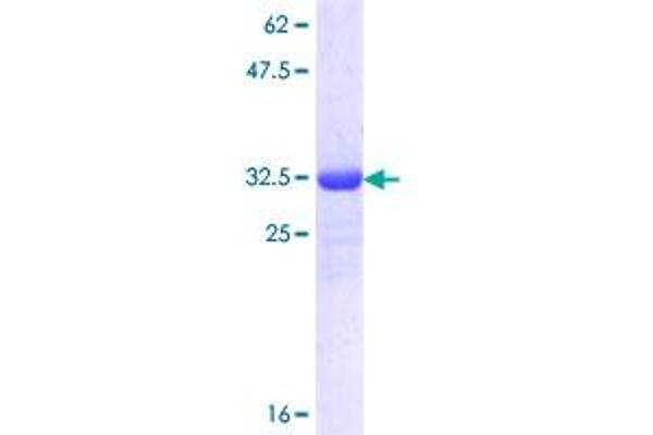 SLC25A12 Protein (AA 112-183) (GST tag)