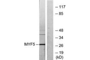 Western blot analysis of extracts from HepG2 cells, using MYF5 Antibody. (MYF5 抗体  (AA 61-110))