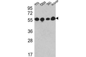 Western Blotting (WB) image for anti-Tubulin, beta (TUBB) antibody (ABIN5014943) (TUBB 抗体)