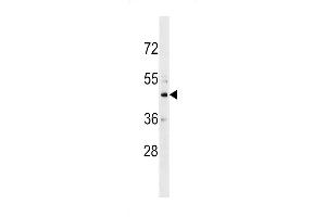 Western blot analysis in HL-60 cell line lysates (35ug/lane). (CHST10 抗体  (C-Term))