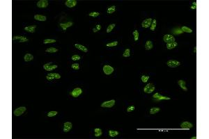 Immunofluorescence of purified MaxPab antibody to NCL on HeLa cell. (Nucleolin 抗体  (AA 1-710))