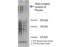 Piccolo Western Blot. (PCLO 抗体)