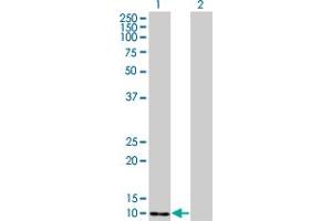 Western Blotting (WB) image for anti-S100 Calcium Binding Protein A4 (S100A4) (AA 1-101) antibody (ABIN562767)